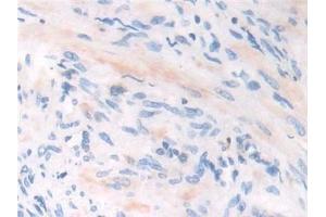 Detection of IFI30 in Human Prostate Tissue using Polyclonal Antibody to Interferon Gamma Inducible Protein 30 (IFI30)