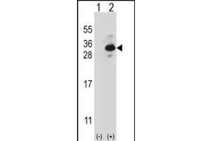 Western blot analysis of CLTB (arrow) using rabbit polyclonal CLTB Antibody (ABIN656850 and ABIN2846055). (CLTB anticorps)