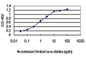 Detection limit for recombinant GST tagged LIMK1 is approximately 0. (LIM Domain Kinase 1 anticorps  (AA 548-647))