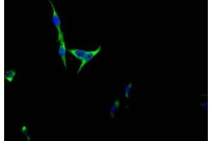 Immunofluorescence staining of HepG2 Cells with ABIN7127489 at 1:50, counter-stained with DAPI. (Recombinant FGFR3 anticorps)