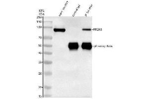 Immunoprecipitating (IP) PROX1 in SH-SY5Y whole cell lysate. (PROX1 anticorps  (AA 51-737))