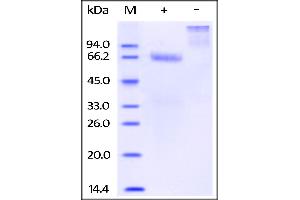 Biotinylated Human Mesothelin (aa 296-580), Fc tag on SDS-PAGE under reducing (R) condition. (Mesothelin Protein (MSLN) (AA 296-580) (Fc Tag,Biotin))