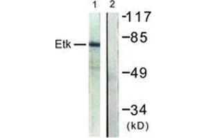 Western Blotting (WB) image for anti-BMX Non-Receptor Tyrosine Kinase (BMX) (AA 6-55) antibody (ABIN2888731) (BMX anticorps  (AA 6-55))