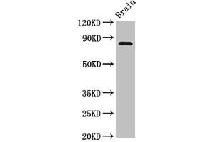 Western Blot Positive WB detected in: Rat brain tissue All lanes: Loxl4 antibody at 4 μg/mL Secondary Goat polyclonal to rabbit IgG at 1/50000 dilution Predicted band size: 85 kDa Observed band size: 85 kDa (LOXL4 anticorps  (AA 26-757))