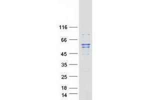 Validation with Western Blot