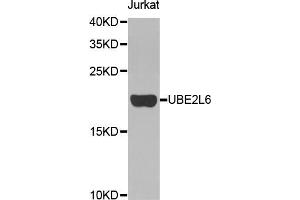 Western blot analysis of extracts of Jurkat cells, using UBE2L6 antibody (ABIN5972395). (UBE2L6 anticorps)
