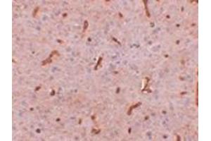 anti-Tetratricopeptide Repeat Domain 5 (TTC5) (C-Term) antibody