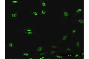 Immunofluorescence of purified MaxPab antibody to SF3B2 on HeLa cell.