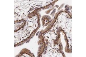 Immunohistochemical staining of human placenta with CXorf15 polyclonal antibody  shows cytoplasmic positivity in trophoblastic cells at 1:1000-1:2500 dilution. (Taxilin gamma (TXLNG) (AA 408-522) anticorps)