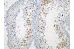 Immunohistochemistry of normal testis (formalin fixed) after antigen retreival, stained with Anti-Mad2L1 (clone 17D10)). (MAD2L1 anticorps)