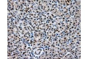 Immunohistochemical staining of paraffin-embedded Carcinoma of liver tissue using anti-CYP1A2 mouse monoclonal antibody. (CYP1A2 anticorps)