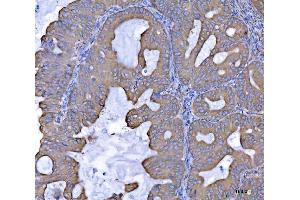 IHC analysis of SEPT7/SEPTIN7 using anti-SEPT7/SEPTIN7 antibody (ABIN7599301). (Septin 7 anticorps  (AA 1-351))