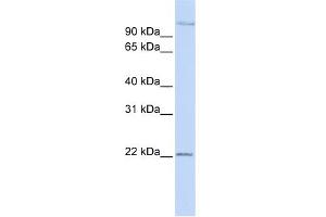 WB Suggested Anti-PDS5B Antibody Titration: 0. (PDS5B anticorps  (Middle Region))