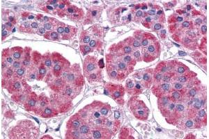 Human Adrenal: Formalin-Fixed, Paraffin-Embedded (FFPE) (EIF4G2 anticorps  (AA 1-204))