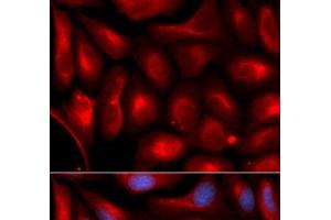 Immunofluorescence analysis of U2OS cells using PSMA5 Polyclonal Antibody (PSMA5 anticorps)