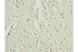 Immunohistochemistry of paraffin-embedded human brain tissue using ABIN7151242 at dilution of 1:100 (TRIM13 anticorps  (AA 40-310))