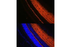 Immunofluorescence analysis of rat eye using SYT1 Rabbit pAb (ABIN3021249, ABIN3021250, ABIN3021251 and ABIN6214085) at dilution of 1:100 (40x lens).