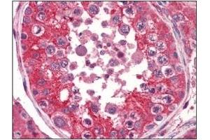 Immunohistochemistry (IHC) image for anti-EPH Receptor A2 (EPHA2) (AA 559-976) antibody (ABIN317512) (EPH Receptor A2 anticorps  (AA 559-976))