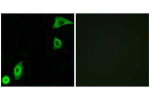 Immunofluorescence analysis of A549 cells, using RPS20 antibody. (RPS20 anticorps  (Internal Region))
