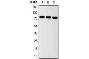 Western blot analysis of ITIH2 expression in MCF7 (A), mouse brain (B), rat brain (C) whole cell lysates. (ITIH2 anticorps  (Center))