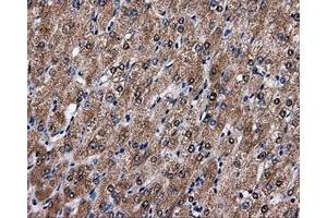 Immunohistochemical staining of paraffin-embedded liver tissue using anti-FAHD2Amouse monoclonal antibody. (FAHD2A anticorps)