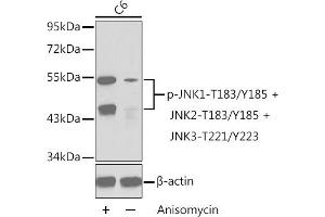 Western blot analysis of extracts from C6 cells untreated or treated with anisomycin using Phospho-JNK1-T183/Y185 + JNK2-T183/Y185 + JNK3-T221/Y223 Antibody (ABIN3020000, ABIN3020001, ABIN3020002 and ABIN7101867). (MAPK8/9/10 anticorps  (pThr221, pTyr223))