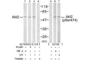 Image no. 2 for anti-V-Akt Murine Thymoma Viral Oncogene Homolog 2 (AKT2) (Ser474) antibody (ABIN197358) (AKT2 anticorps  (Ser474))