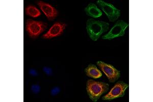 ABIN6260452 and ABIN6278012 staining Hela cells by IF/ICC. (Calpain S1 anticorps  (Internal Region))