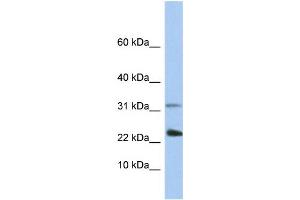 WB Suggested Anti-EXOSC3 Antibody Titration:  0. (EXOSC3 anticorps  (C-Term))