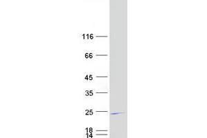 Validation with Western Blot