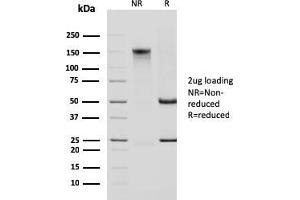 SDS-PAGE Analysis Purified Cytokeratin 14 Mouse Monoclonal Antibody (KRT14/2375).