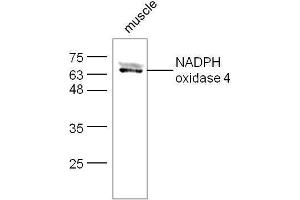 Mouse muscle lysates probed with Rabbit Anti-NADPH oxidase 4 Polyclonal Antibody, Unconjugated  at 1:500 for 90 min at 37˚C. (NADPH Oxidase 4 anticorps  (AA 81-180))