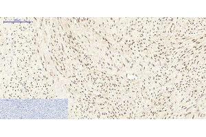 Immunohistochemistry of paraffin-embedded Human uterus tissue using PPARD Monoclonal Antibody at dilution of 1:200. (PPARD anticorps)