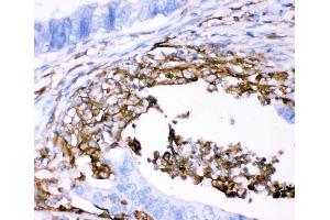 IHC analysis of CD18/ITGB2 using anti-CD18/ITGB2 antibody (ABIN3043260). (Integrin beta 2 anticorps  (AA 404-769))