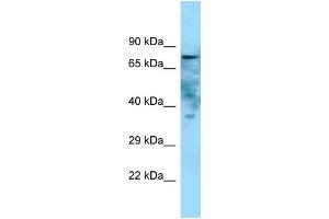 WB Suggested Anti-Golim4 Antibody   Titration: 1. (Golgi Integral Membrane Protein 4 (GOLIM4) (C-Term) anticorps)