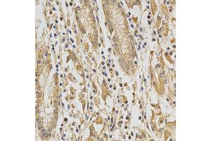Immunohistochemistry of paraffin-embedded human stomach using DNMT3A antibody at dilution of 1:200 (x400 lens) (DNMT3A anticorps)
