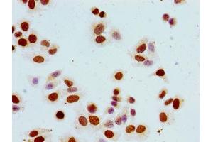 Immunocytochemistry analysis of HepG2 cells using ABIN7139617 at dilution of 1:100