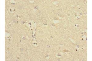 Immunohistochemistry of paraffin-embedded human brain tissue using ABIN7174101 at dilution of 1:100 (PTPN18 anticorps  (AA 1-210))
