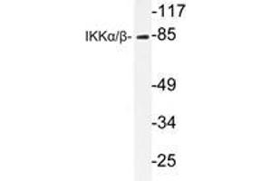 Western blot analysis of IKKα/β antibody in extracts from Jurkat cells. (IKK alpha anticorps)