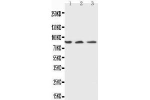 Anti-Ku80 antibody,  Western blotting Lane 1: U87 Cell Lysate Lane 2: A549 Cell Lysate Lane 3: MCF-7 Cell Lysate (XRCC5 anticorps  (C-Term))