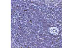 IHC analysis of TFEB using anti-TFEB antibody (ABIN7600648).