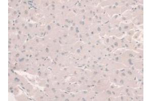 IHC-P analysis of Human Liver Tissue, with DAB staining. (HFE2 anticorps  (AA 234-416))