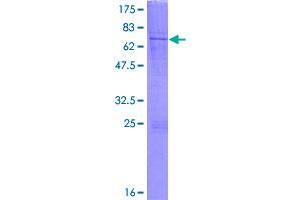 Image no. 1 for Lipoyltransferase 1 (LIPT1) (AA 1-373) protein (GST tag) (ABIN1309475)