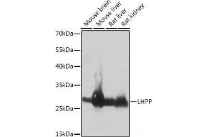 Western blot analysis of extracts of various cell lines using LHPP Polyclonal Antibody at dilution of 1:1000. (LHPP anticorps)