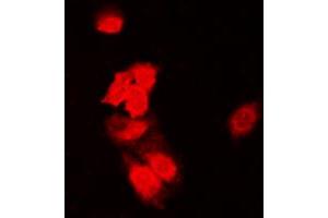 Immunofluorescent analysis of SIAH1/2 staining in HeLa cells. (SIAH1/2 anticorps  (Center))