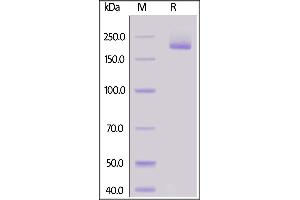 Human Siglec-1, His Tag on  under reducing (R) condition. (Sialoadhesin/CD169 Protein (AA 20-1641) (His tag))