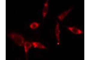 ABIN6275780 staining  293 cells by IF/ICC. (MX2 anticorps  (Internal Region))