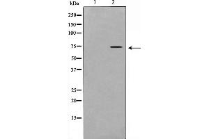 Western blot analysis on Jurkat cell lysate using DCP1A Antibody,The lane on the left is treated with the antigen-specific peptide. (DCP1A anticorps  (Internal Region))