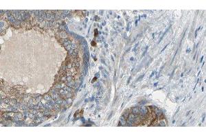 ABIN6275626 at 1/100 staining Human prostate tissue by IHC-P. (CCT6A anticorps  (Internal Region))