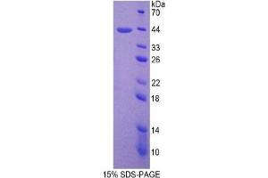 SDS-PAGE of Protein Standard from the Kit (Highly purified E. (SFTPD Kit ELISA)